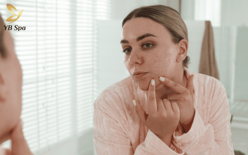 Peel da có đẩy mụn không? Cách phân biệt đẩy mụn và kích ứng 13 Việc chạm tay bẩn lên da lúc này sẽ làm trầm trọng thêm tình trạng mụn và khiến làn da yếu ớt dễ bị tổn thương hơn