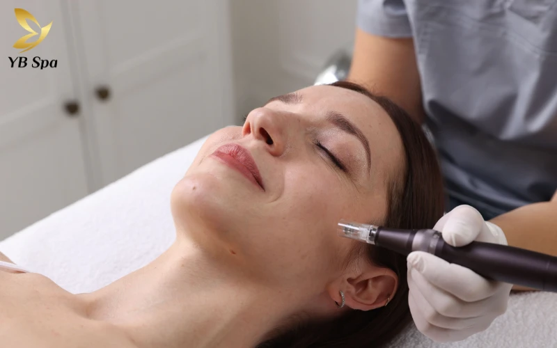 Peel da giá bao nhiêu? Bảng giá tham khảo mới nhất 2026 tại TP.HCM 10 Sử dụng bộ lăn kim chuyên dụng tạo các vi tổn thương siêu nhỏ để kích thích da tự tái tạo, mờ sẹo và tăng độ đàn hồi