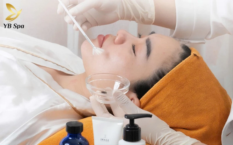 Peel da trị mụn là gì? Có an toàn và hiệu quả không? 36 Tiến hành peel da