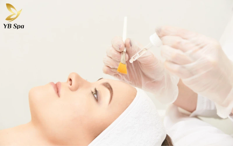 Peel da trị mụn là gì? Có an toàn và hiệu quả không? 28 Peel da hóa học (Chemical Peel)