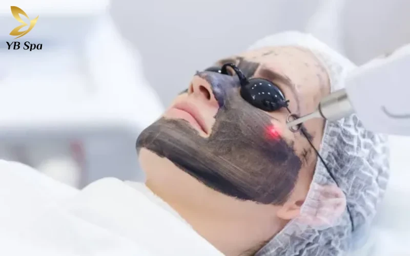 Peel da trị mụn là gì? Có an toàn và hiệu quả không? 29 Peel da bằng laser