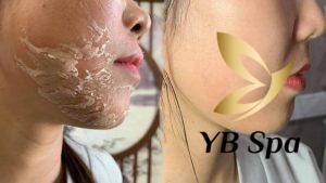 Peel da xong có nên đắp mặt nạ không? Nên đắp mặt nạ gì?