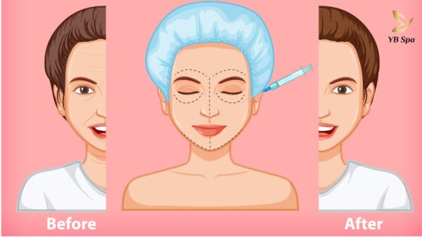 Phuong Phap Xoa Nhan