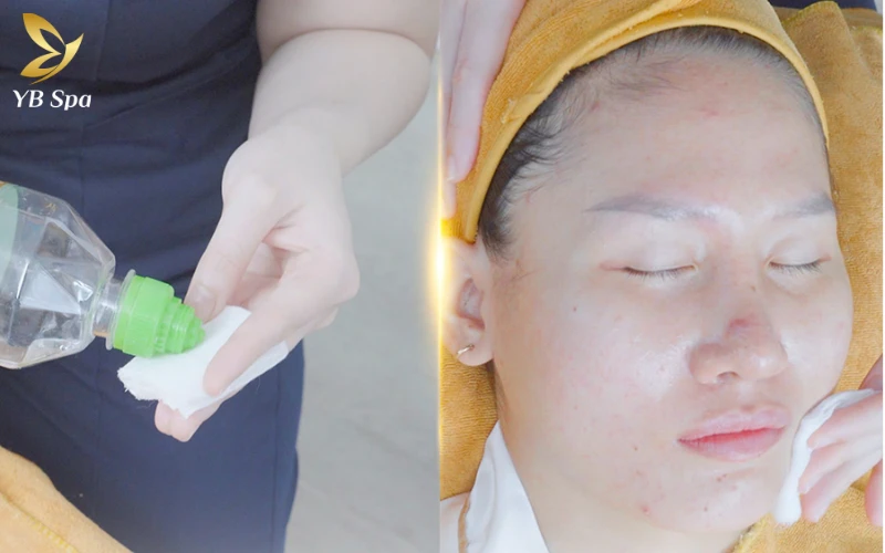 Bước vệ sinh kháng khuẩn toàn diện giúp loại bỏ vi khuẩn cơ hội, ngăn chặn hoàn toàn nguy cơ nhiễm trùng chéo và viêm nhiễm lan rộng.