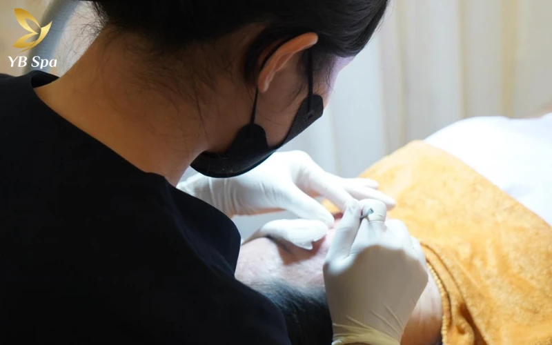 Thao tác khéo léo và chuẩn xác giúp lấy sạch nhân mụn nhưng vẫn giảm thiểu cảm giác đau đớn đến mức tối đa cho khách hàng.