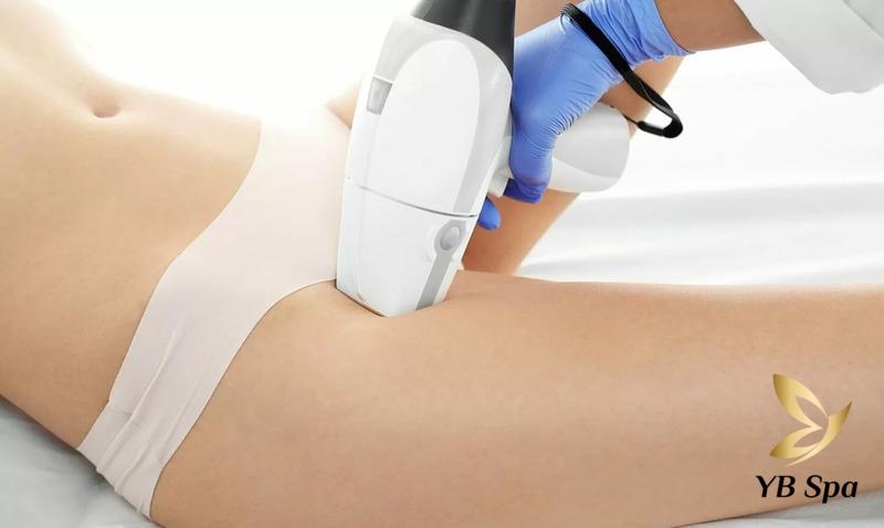 Quy Trình Triệt Lông Bikini Chuẩn Y Khoa - Vĩnh Viễn, An Toàn, Hiệu Quả 21 Triệt lông vùng kín