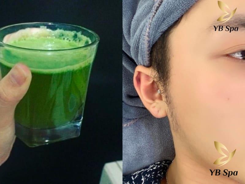 Rau diếp cá trị mụn có được không? Cần lưu ý gì? 28 Uống nước rau diếp cá giúp thanh nhiệt, giải độc từ bên trong, hỗ trợ điều trị mụn hiệu quả hơn.