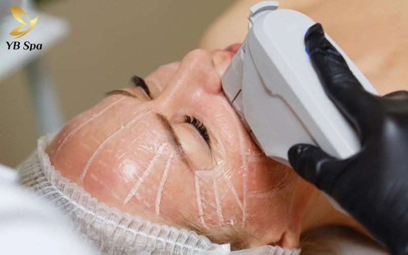 Tổng quan về công nghệ LinearZ