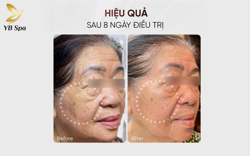 Hiệu quả thực tế