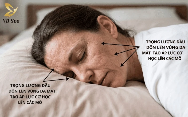 Tránh nằm áp mặt xuống gối là cách quan trọng để bảo vệ các đường nét vừa được nâng lên, ngăn ngừa biến dạng tạm thời