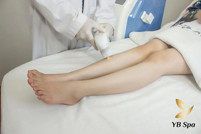 Trước và sau khi triệt lông bằng laser nên làm gì? 29 Một số lầm tưởng về triệt lông vĩnh viễn bằng laser: không đau, hiệu quả vĩnh viễn