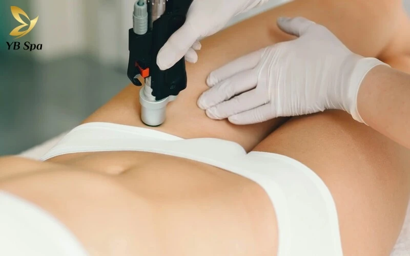 Hình ảnh sau khi triệt lông vùng kín và timeline thay đổi của da sau triệt lông 11 Cận cảnh kết quả triệt lông vùng kín theo tiêu chuẩn da liễu 2026: Từ những phản ứng nhẹ ban đầu đến độ hoàn thiện tối ưu