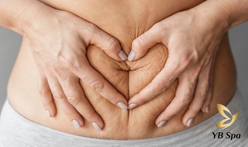 Sau Sinh Tắm Gì Cho Trắng Da? 9 Cách Tắm Trắng Thiên Nhiên 24 Da bị sạm đen sau khi sinh