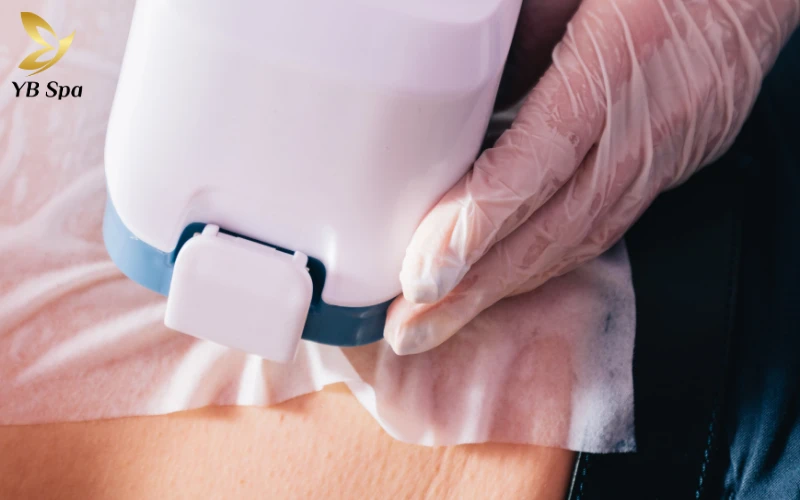 Sẹo lồi có tự hết không? Giải mã nguyên nhân và phương pháp điều trị 29 Liệu pháp áp lạnh (Cryotherapy)