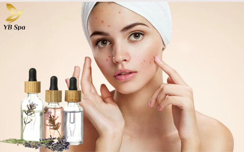 serum trị sẹo thâm và sáng da hiệu quả