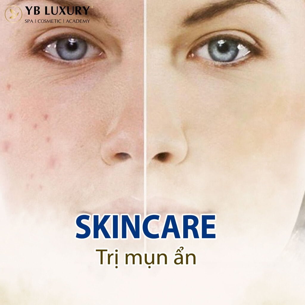 Skincare Tri Mun An
