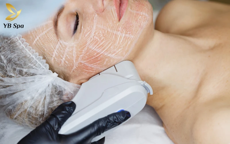 Density và Thermage – hai công nghệ nâng cơ được ưa chuộng hiện nay.