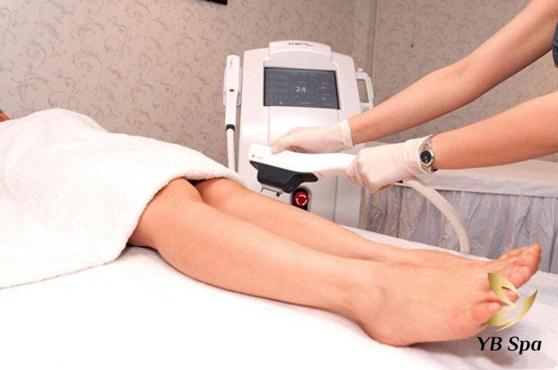 So sánh Lathentic với Elight: Công nghệ triệt lông nào tốt hơn? 18 Công nghệ triệt lông Lathentic là gì? (Nguồn: Internet)