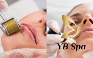 So sánh tiêm Meso và lăn kim về đối tượng phù hợp (Nguồn: Internet)