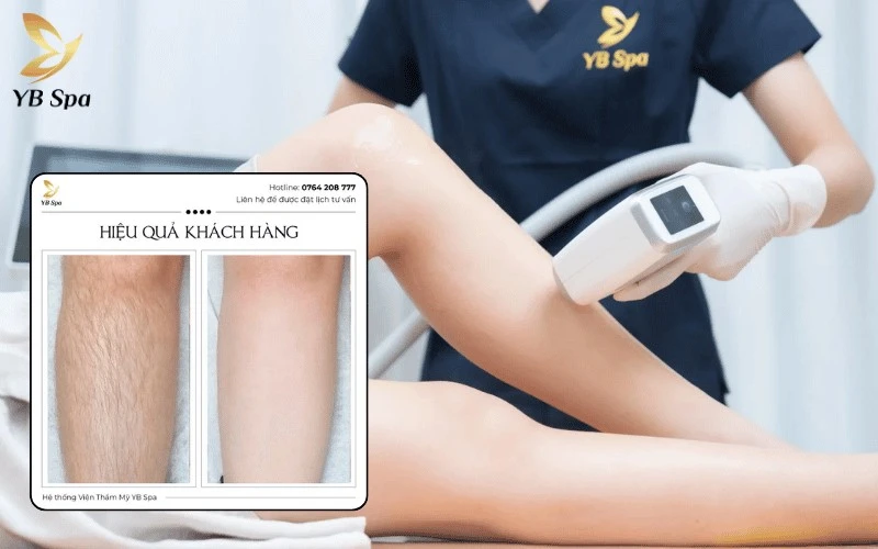 Trải nghiệm triệt lông không đau rát nhờ Nano Diamond Light, công nghệ tiên tiến giúp bảo vệ biểu bì và se khít lỗ chân lông hiệu quả