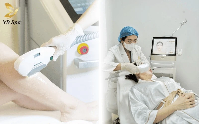 YB Spa dẫn đầu xu hướng làm đẹp không xâm lấn với các công nghệ hiện đại giúp đạt hiệu quả tối ưu mà không cần nghỉ dưỡng
