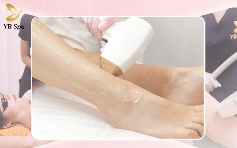 Tận hưởng công nghệ triệt lông hiện đại với mức giá cực kỳ ưu đãi, chỉ dao động từ 290.000 VNĐ đến 899.000 VNĐ/buổi