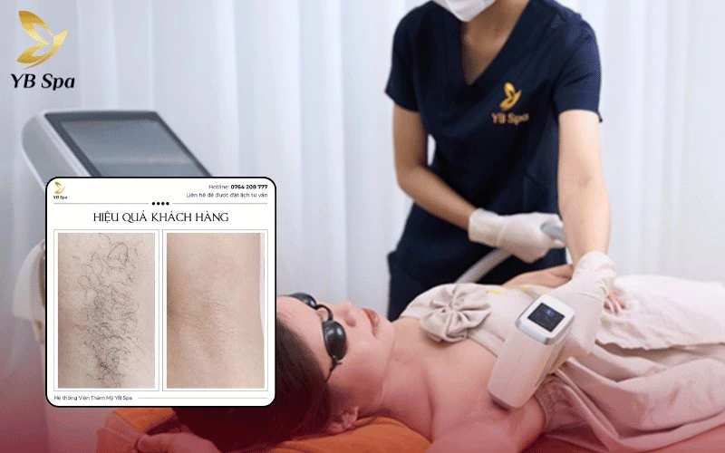 Top 10 Địa Chỉ Spa Quận 1 Uy Tín, Chất Lượng 2026 16 Trải nghiệm triệt lông vĩnh viễn an toàn và nhanh chóng cùng công nghệ Nano Diamond Light hiện đại nhất tại hệ thống YB Spa