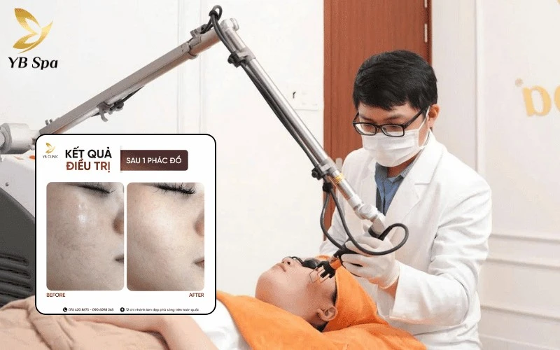 Top 10 Địa Chỉ Spa Quận 1 Uy Tín, Chất Lượng 2026 18 Lấy lại làn da đều màu tự nhiên với liệu trình điều trị mao mạch bằng Laser Chrome an toàn và không gây tổn thương da