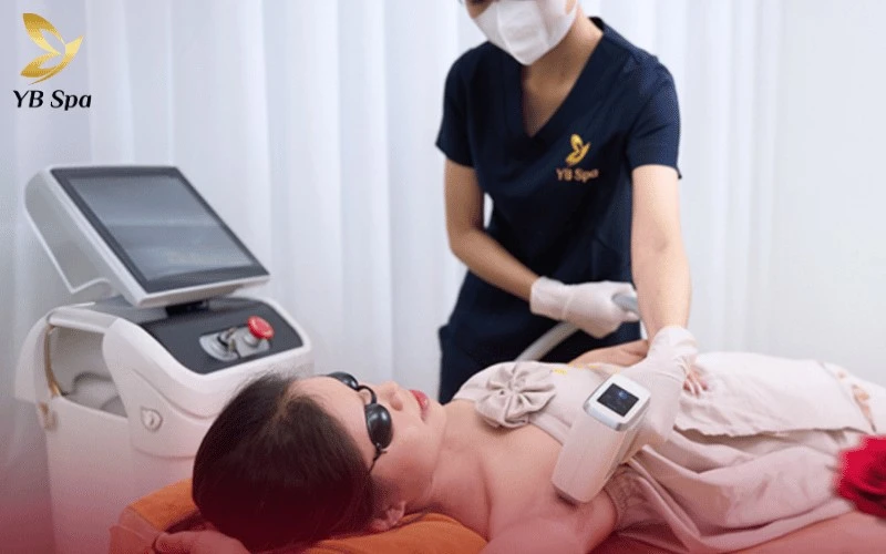 YB Spa mang đến giải pháp tối ưu kết hợp giữa triệt lông vĩnh viễn và đánh bay thâm sạm cho vùng da nhạy cảm bằng ánh sáng Nano Diamond
