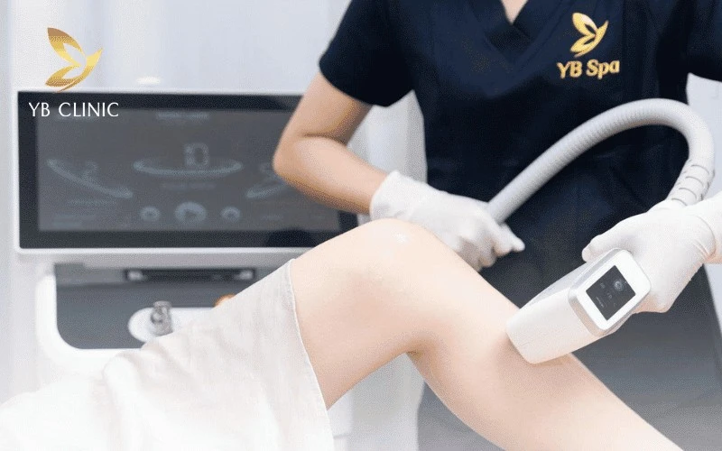 YB Spa ứng dụng siêu công nghệ Nano Diamond Light giúp triệt lông tận gốc ở giai đoạn phát triển một cách nhẹ nhàng và không xâm lấn
