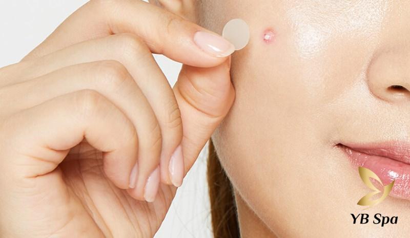 tác hại của miếng dán mụn