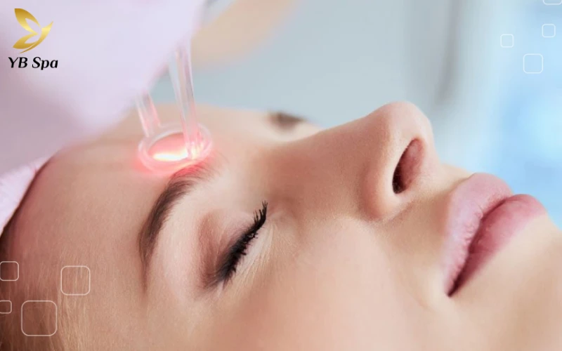 Tại sao bị nổi mụn thịt ở cổ? 22 Đốt Laser Co2 Fractional (carbon Dioxide Laser)