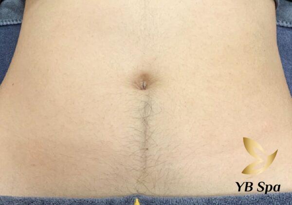 Tại sao con gái lại có lông bụng? (Nguồn: Internet)