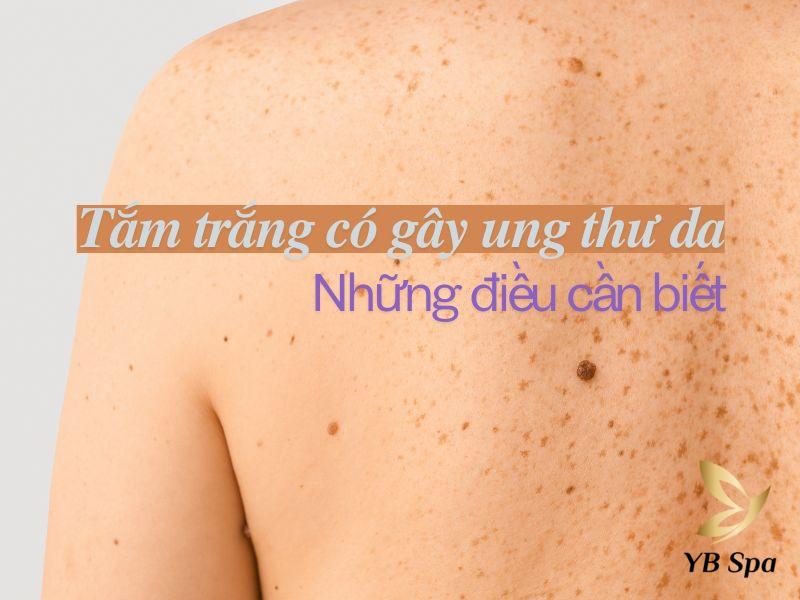 Tắm trắng có gây ung thư da không? Những điều cần biết 18 tam trang co gay ung thu da