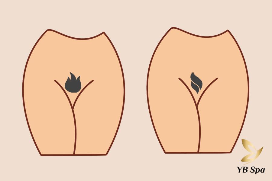 Triệt Lông Bikini Tạo Hình Là Gì? 13 Kiểu Tạo Hình Mới Nhất 32 Lông bikini theo phong cách playboy