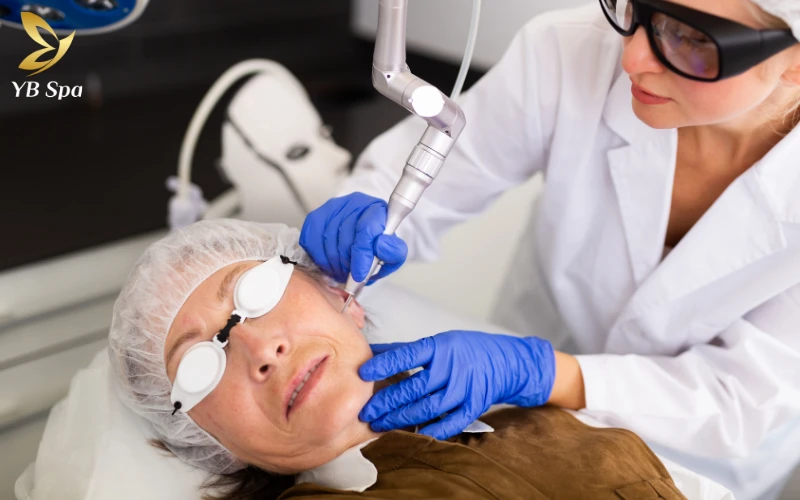 Tẩy nốt ruồi bị sẹo lõm phải làm sao? Nguyên nhân và cách xử lý hiệu quả 26 Phương pháp Laser CO2 truyền thống