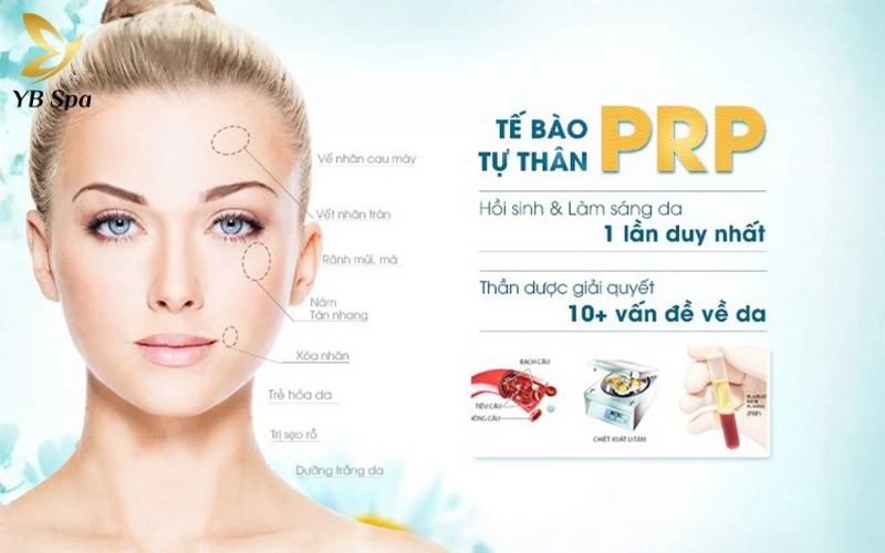 Tẩy nốt ruồi bị sẹo lõm phải làm sao? Nguyên nhân và cách xử lý hiệu quả 31 Phương Pháp PRP (Huyết Tương Giàu Tiểu Cầu)