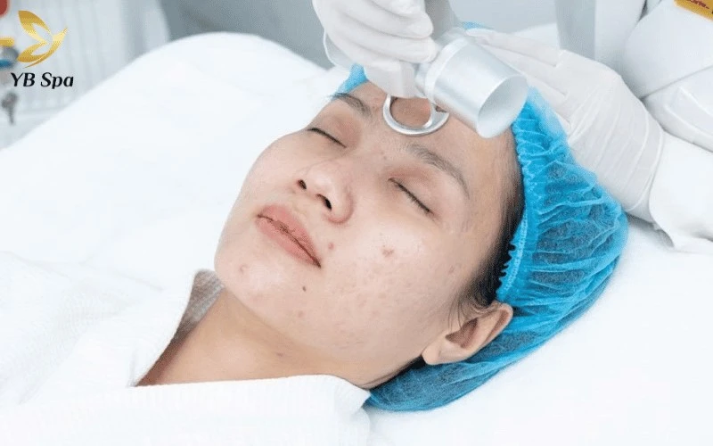 Top 6 Thẩm Mỹ Viện Bình Dương Uy Tín, Chất Lượng 2026 14 Trải nghiệm liệu trình trị sẹo chuyên sâu an toàn tuyệt đối nhờ hệ thống máy tân tiến tại thẩm mỹ viện Seoul Center
