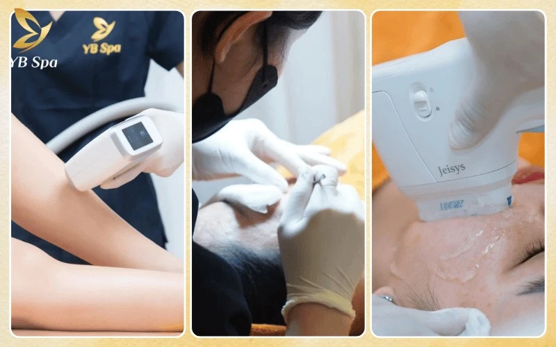 Top 8 Thẩm Mỹ Viện Phú Nhuận Uy Tín, Chất Lượng 2026 11 Điểm sáng tại YB Spa là các giải pháp thẩm mỹ ứng dụng công nghệ cao và quy trình chuẩn y khoa nhằm tối ưu hóa hiệu quả phục hồi tế bào da