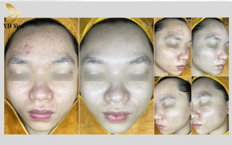 Phác đồ phục hồi da Cortisol hỗ trợ hồi sinh những làn da mỏng yếu và nhạy cảm bằng các dưỡng chất tái tạo chuyên sâu