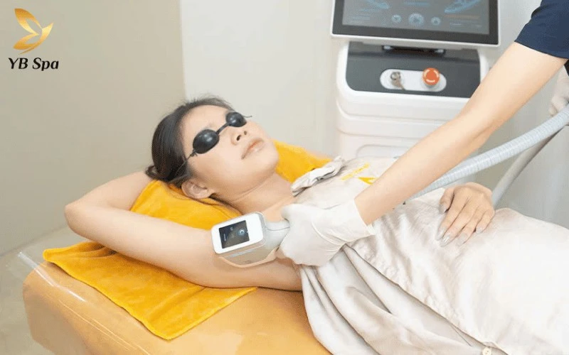 Nano Diamond Light tại YB Spa sử dụng bước sóng thông minh giúp triệt lông tận gốc một cách nhẹ nhàng, hoàn toàn không gây cảm giác bỏng rát hay khó chịu