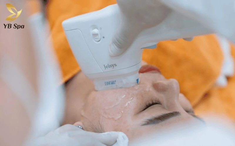 Tạm biệt dấu hiệu lão hóa với sự cộng hưởng từ sóng siêu âm hội tụ và sóng vô tuyến RF trong liệu trình trẻ hóa da chuyên sâu tại YB Spa