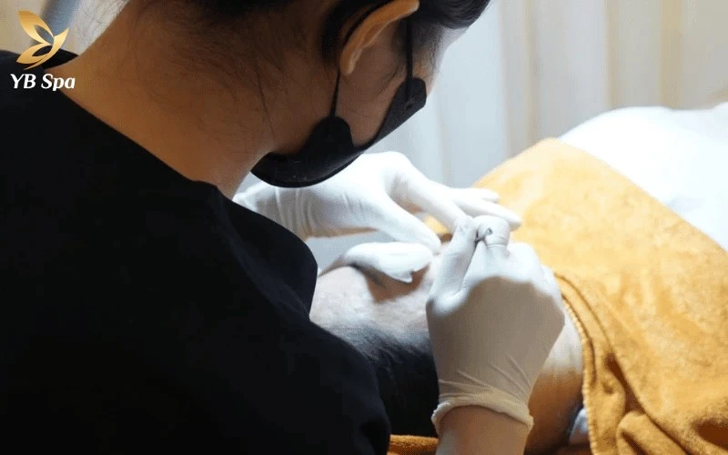 Tạm biệt mụn viêm và bã nhờn với quy trình điều trị 14 bước chuẩn y khoa an toàn tuyệt đối tại YB Spa