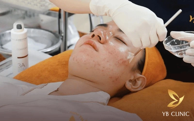 Top 6 Thẩm Mỹ Viện Tân Bình Uy Tín, Chất Lượng 2026 13 YB Spa Tân Bình mang đến sự thoải mái trọn vẹn cho khách hàng với phòng điều trị riêng tư cùng cam kết thực hiện đúng liệu trình, minh bạch về dịch vụ