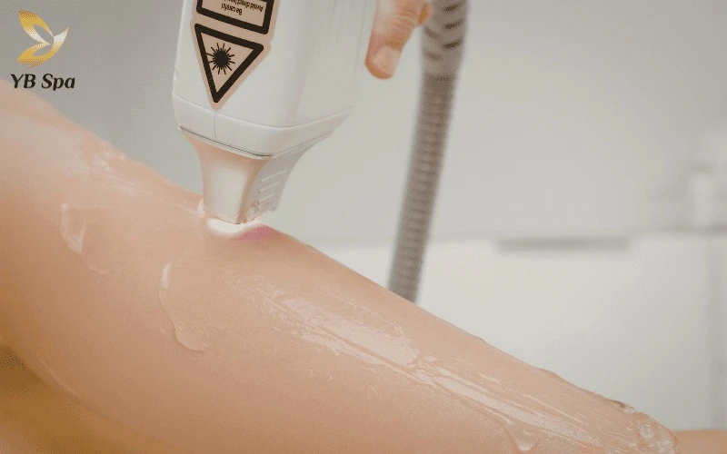 Mỗi sắc tố da có một "ngưỡng chịu nhiệt" riêng, vì vậy công nghệ Laser phải được tùy chỉnh để tác động chính xác vào nang lông mà không làm bỏng bề mặt.