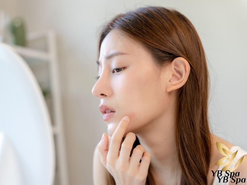 Thức khuya có nổi mụn không? Ảnh hưởng đến da như thế nào? 23 ban đêm là khoảng thời gian để cơ thể đào thải những độc tố và cũng là khung giờ để các bộ phận trên cơ thể nghỉ ngơi