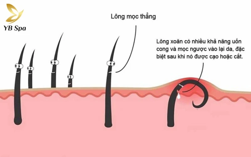 Cách tỉa lông vùng kín nữ bằng kéo an toàn, tránh ngứa 20 Chuẩn bị bộ dụng cụ chuyên dụng giúp quy trình grooming tại nhà trở nên chuyên nghiệp và an toàn tuyệt đối