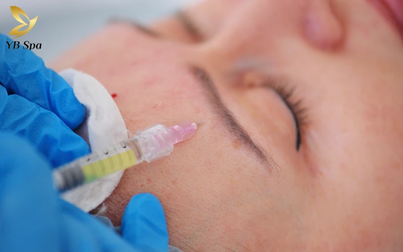 Khám phá tần suất tiêm meso chuẩn y khoa để duy trì làn da căng bóng bền vững mà không gây quá tải cho da.