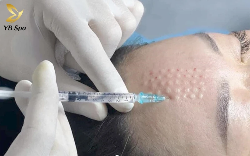 Dù là sự lan tỏa mạnh mẽ của BAP hay sự tỉ mỉ của Nappage, mỗi kỹ thuật đều đóng vai trò quan trọng trong việc tối ưu hóa kết quả trẻ hóa