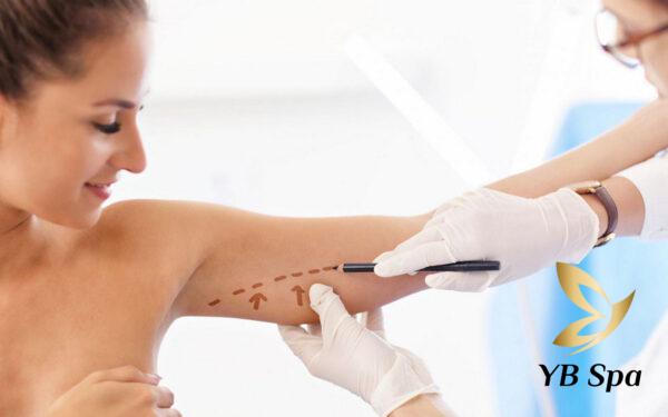 Tiêm meso bắp tay